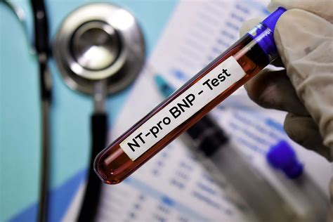 peptides tb 500 benefits
