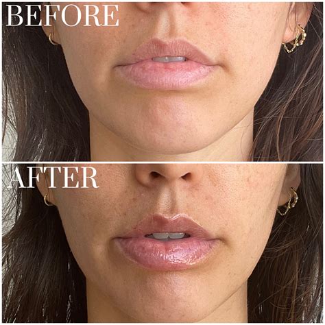 tb500 peptide online